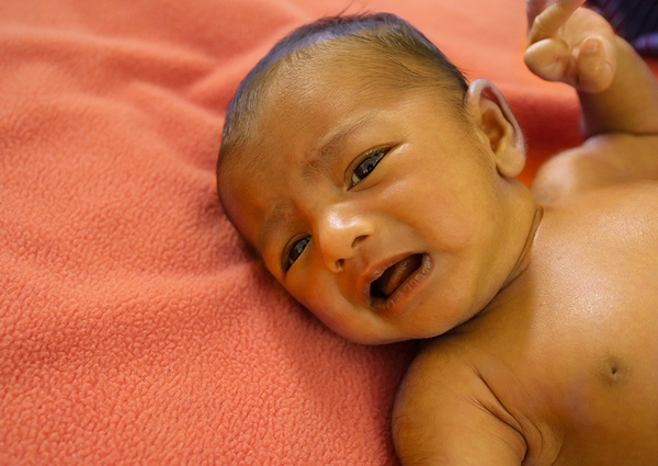 Common baby skin conditions