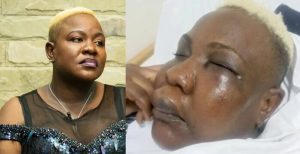 Full Figure seeks justice after violent assault